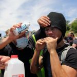 how to stop pepper spray burn on skin