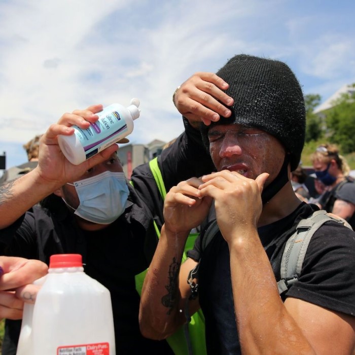 How to Stop Pepper Spray Burn on Skin: Quick Relief Tips缩略图 how to stop pepper spray burn on skin