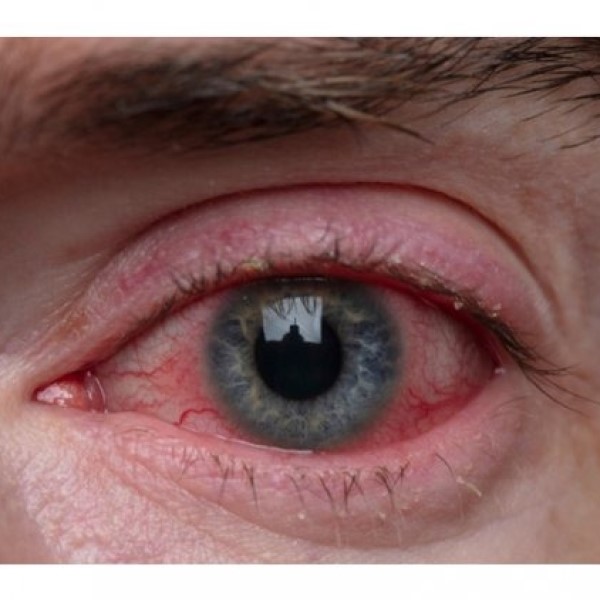 Can Pepper Spray Cause Permanent Damage? Know the Facts插图4 can pepper spray cause permanent damage