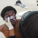 Can Pepper Spray Damage Your Eyes? Exploring the Risks Today缩略图 can pepper spray damage your eyes