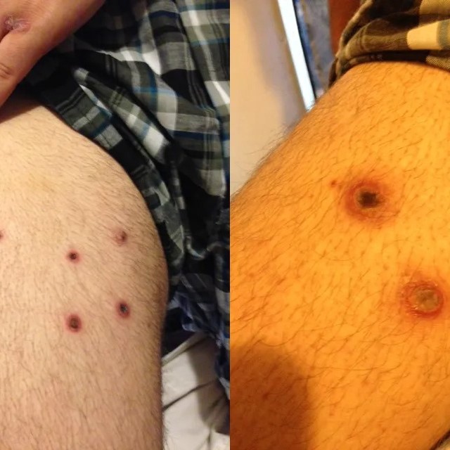 What to Know About Stun Gun Marks: A Guide for Users插图3 stun gun marks