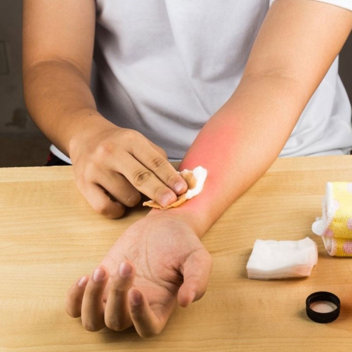 does pepper spray burn skin