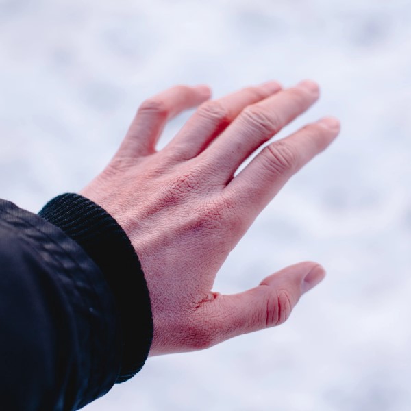 how long does it take to get frostbite