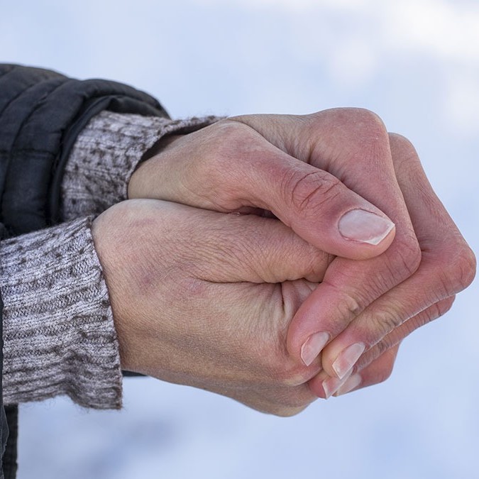 what is the best prevention for frostbite?