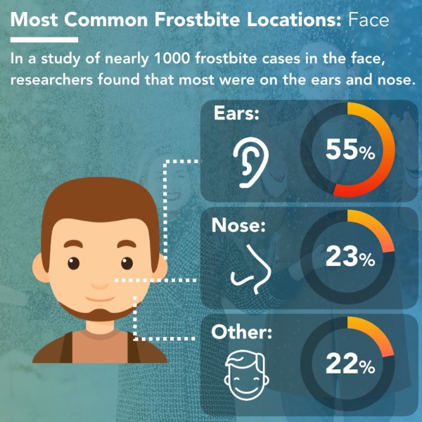 how long does it take to get frostbite