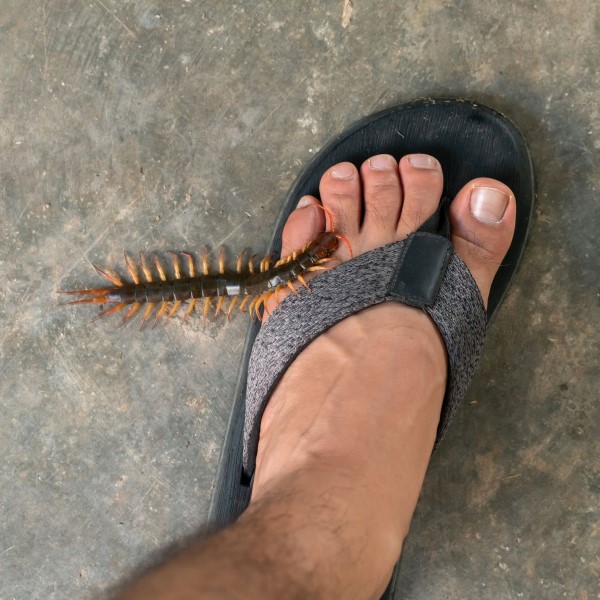 centipede bite