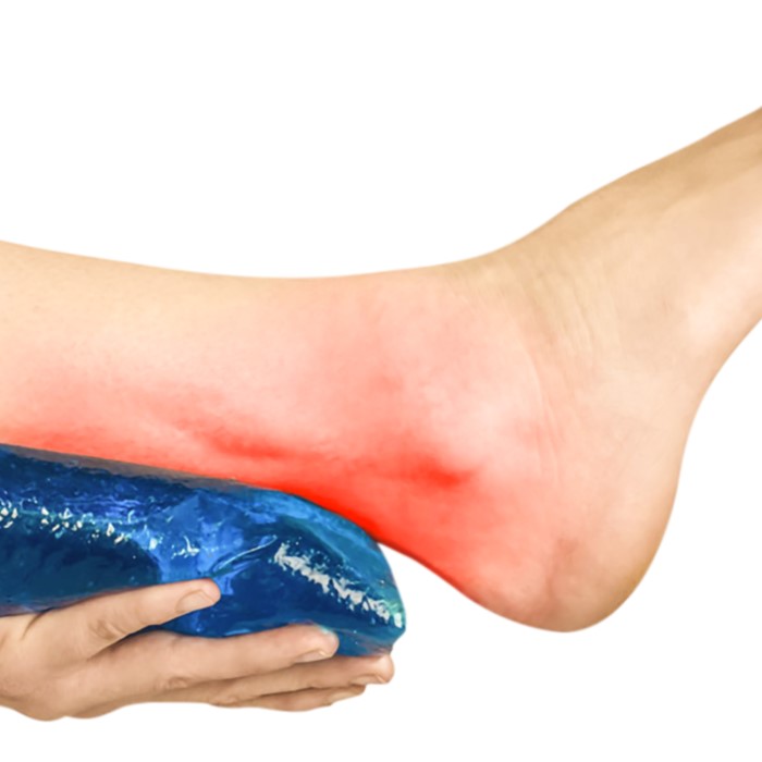 how long should you ice an injury